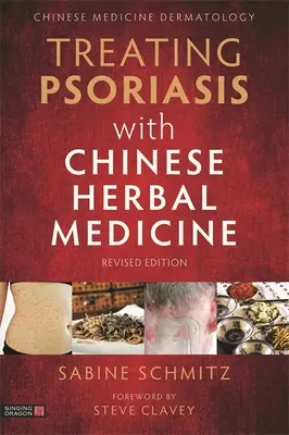 Tratarea psoriazisului cu plante medicinale chinezești (ediție revizuită): Un manual practic - Treating Psoriasis with Chinese Herbal Medicine (Revised Edition): A Practical Handbook