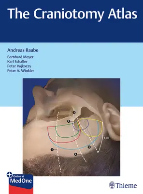 Atlasul craniotomiei - The Craniotomy Atlas