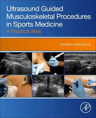 Proceduri musculo-scheletice ghidate de ultrasunete în medicina sportivă - Un atlas practic - Ultrasound Guided Musculoskeletal Procedures in Sports Medicine - A Practical Atlas