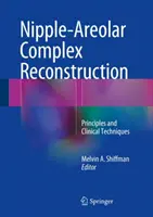 Nipple-Areolar Complex Reconstruction: Principii și tehnici clinice - Nipple-Areolar Complex Reconstruction: Principles and Clinical Techniques