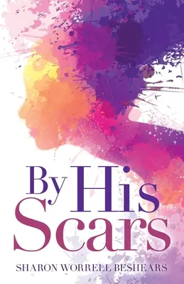 Prin cicatricile lui - By His Scars