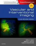 Imagistică vasculară și intervențională: Seria de revizuire a cazurilor - Vascular and Interventional Imaging: Case Review Series