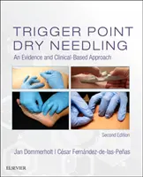 Acționarea uscată a punctelor Trigger: O abordare bazată pe dovezi și clinică - Trigger Point Dry Needling: An Evidence and Clinical-Based Approach