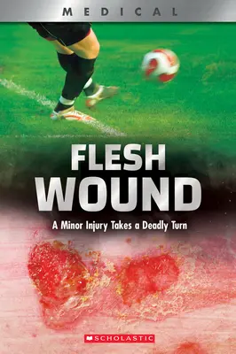 Flesh Wound (Xbooks): O rană minoră ia o întorsătură mortală - Flesh Wound (Xbooks): A Minor Injury Takes a Deadly Turn