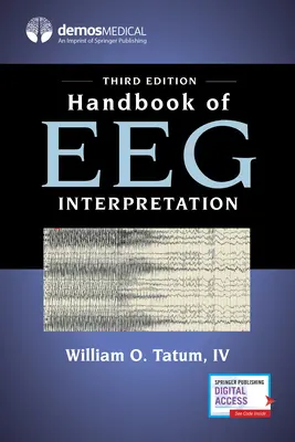 Manual de interpretare a Eeg - Handbook of Eeg Interpretation