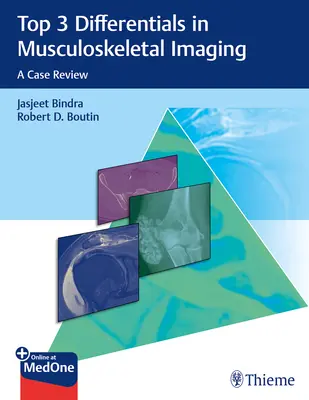 Top 3 diferențiale în imagistica musculo-scheletală: O analiză de caz - Top 3 Differentials in Musculoskeletal Imaging: A Case Review
