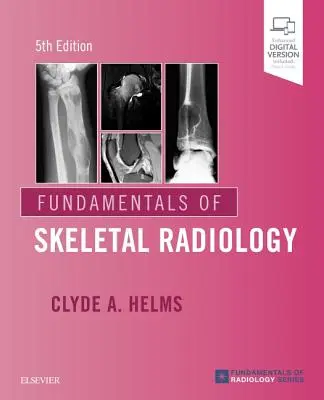 Fundamentele radiologiei scheletice - Fundamentals of Skeletal Radiology