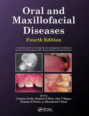 Boli orale și maxilo-faciale, ediția a patra - Oral and Maxillofacial Diseases, Fourth Edition