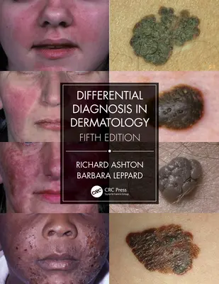 Diagnosticul diferențial în dermatologie - Differential Diagnosis in Dermatology