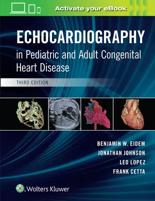 Ecocardiografia în bolile cardiace congenitale pediatrice și adulte - Echocardiography in Pediatric and Adult Congenital Heart Disease