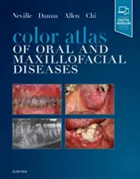 Atlas color al bolilor orale și maxilo-faciale - Color Atlas of Oral and Maxillofacial Diseases