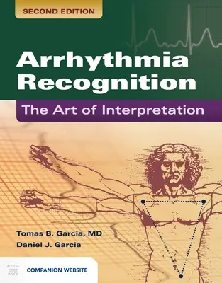 Recunoașterea aritmiei: Arta interpretării: Arta interpretării - Arrhythmia Recognition: The Art of Interpretation: The Art of Interpretation