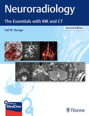 Neuroradiologie: Esențial cu RM și CT - Neuroradiology: The Essentials with MR and CT