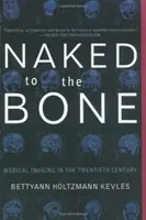 Nud până la os: Imagistica medicală în secolul al XX-lea - Naked to the Bone: Medical Imaging in the Twentieth Century