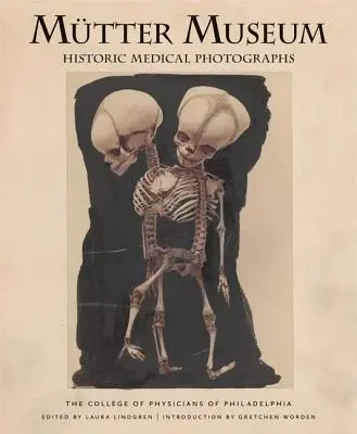 Fotografii medicale istorice ale Muzeului Mtter - Mtter Museum Historic Medical Photographs
