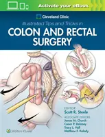 Sfaturi și trucuri ilustrate ale Clinicii Cleveland în chirurgia colonului și rectului - Cleveland Clinic Illustrated Tips and Tricks in Colon and Rectal Surgery
