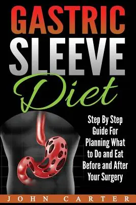 Dieta Gastric Sleeve: Ghid pas cu pas pentru planificarea a ceea ce trebuie să faceți și să mâncați înainte și după operație - Gastric Sleeve Diet: Step By Step Guide For Planning What to Do and Eat Before and After Your Surgery