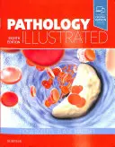 Patologie ilustrată - Pathology Illustrated