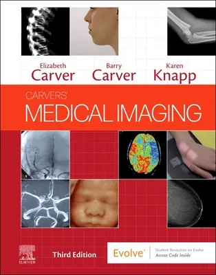 Imagistica medicală a sculptorilor - Carvers' Medical Imaging
