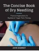 Concise Book of Dry Needling - A Practitioner's Guide to Myofascial Trigger Point Applications