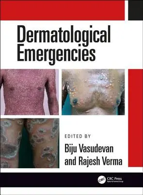 Urgențe dermatologice - Dermatological Emergencies