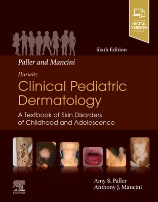 Paller și Mancini - Hurwitz Dermatologie pediatrică clinică: A Textbook of Skin Disorders of Childhood & Adolescence (Un manual de afecțiuni cutanate ale copilăriei și adolescenței) - Paller and Mancini - Hurwitz Clinical Pediatric Dermatology: A Textbook of Skin Disorders of Childhood & Adolescence