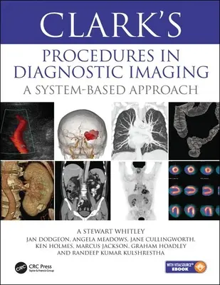 Procedurile lui Clark în imagistica de diagnostic - O abordare bazată pe sistem - Clark's Procedures in Diagnostic Imaging - A System-Based Approach