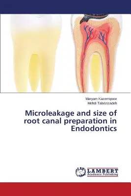 Microinfiltrarea și dimensiunea pregătirii canalului radicular în endodonție - Microleakage and size of root canal preparation in Endodontics
