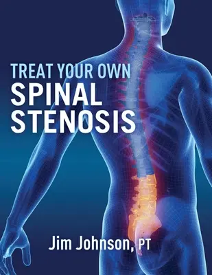 Tratați-vă singur stenoza spinală - Treat Your Own Spinal Stenosis