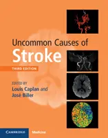 Cauze neobișnuite de accident vascular cerebral - Uncommon Causes of Stroke