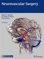 Chirurgie neurovasculară - Neurovascular Surgery
