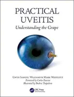 Uveita practică: Înțelegerea strugurilor - Practical Uveitis: Understanding the Grape