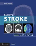 Caplan's Stroke: O abordare clinică - Caplan's Stroke: A Clinical Approach
