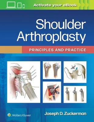 Artroplastia umărului: Principii și practică - Shoulder Arthroplasty: Principles and Practice