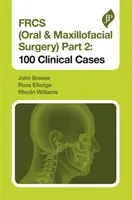 Frcs (Chirurgie orală și maxilofacială) Partea 2: 100 de cazuri clinice - Frcs (Oral & Maxillofacial Surgery) Part 2: 100 Clinical Cases