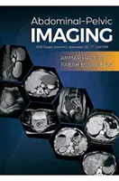 Imagistică abdomino-pelvină - 200 de cazuri (boli comune): US, CT și RMN - Abdominal-Pelvic Imaging - 200 Cases (Common Diseases): US, CT and MRI