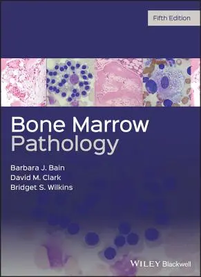 Patologia măduvei osoase - Bone Marrow Pathology