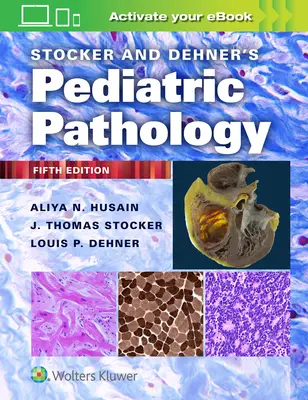 Patologia pediatrică a lui Stocker și Dehner - Stocker and Dehner's Pediatric Pathology