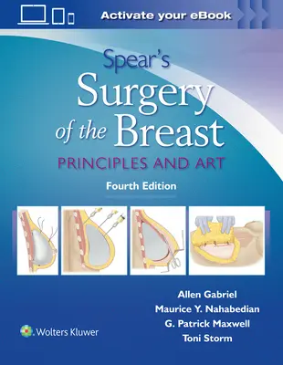 Spear's Surgery of the Breast: Principii și artă - Spear's Surgery of the Breast: Principles and Art