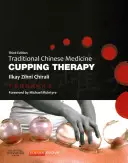 Terapia cu ventuze pentru medicina tradițională chineză - Traditional Chinese Medicine Cupping Therapy