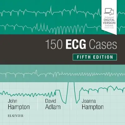 150 de cazuri ECG - 150 ECG Cases
