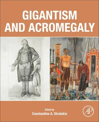 Gigantism și acromegalie - Gigantism and Acromegaly