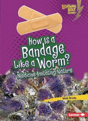 Cum este un bandaj ca un vierme?: Medicina imită natura - How Is a Bandage Like a Worm?: Medicine Imitating Nature