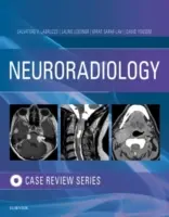 Revizuirea cazurilor de imagistică în neuroradiologie - Neuroradiology Imaging Case Review