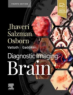 Diagnostic imagistic: Creierul - Diagnostic Imaging: Brain