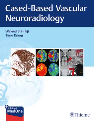 Imagistica în bolile neurovasculare: O abordare bazată pe cazuri - Imaging in Neurovascular Disease: A Case-Based Approach