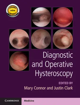 Histeroscopie diagnostică și operativă - Diagnostic and Operative Hysteroscopy