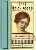 Sick Rose - Or; Disease and the Art of Medical Illustration