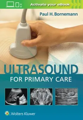 Ultrasunete pentru îngrijirea primară [Cu carte electronică] - Ultrasound for Primary Care [With eBook]
