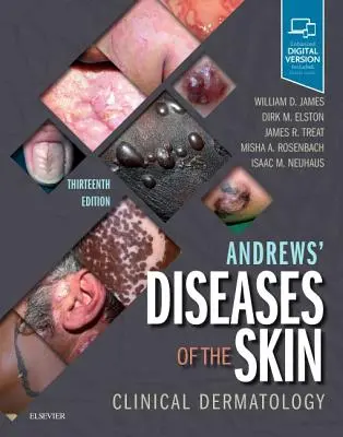 Andrews' Diseases of the Skin: Dermatologie clinică - Andrews' Diseases of the Skin: Clinical Dermatology